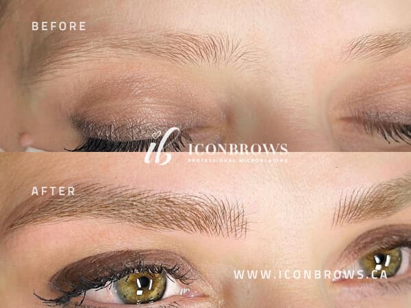 Top Microblading in Toronto, Get Your Brows Enhanced By Iconbrows Lakeshore Downtown.