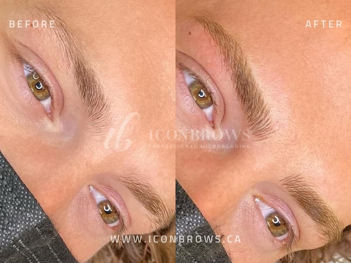 Eyebrow Nano Brows on female done by Iconbrows in toronto.