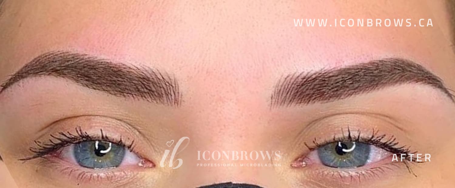 Brows after fusion brows correction by Iconbrows.