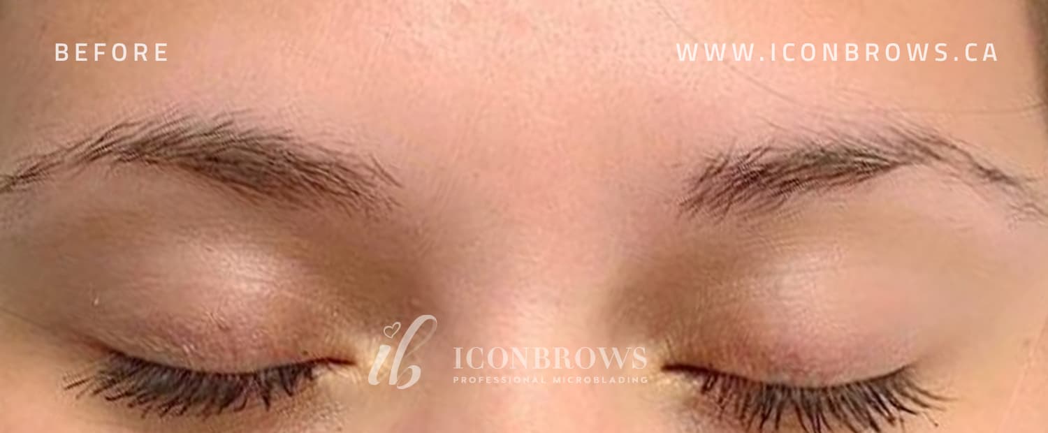 Brows needing correction before fusion brows by Iconbrows.