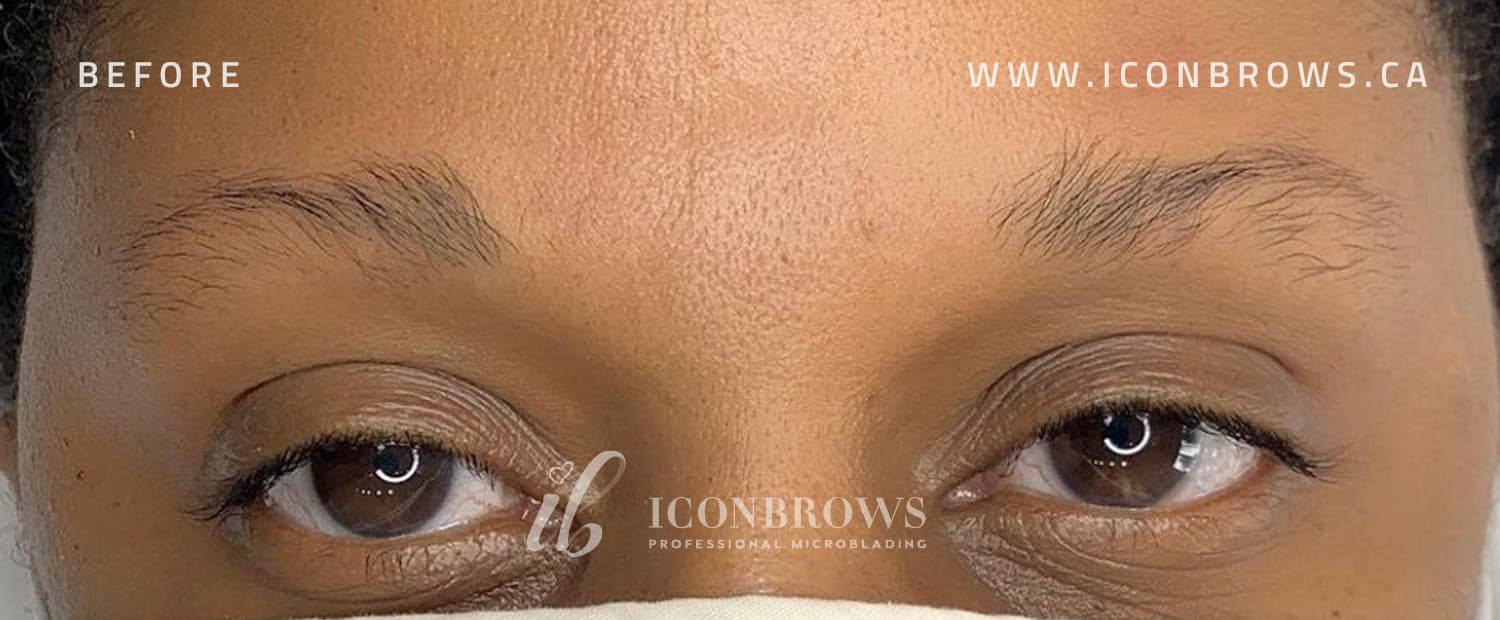 Overplucked brows before fusion brows by Iconbrows.
