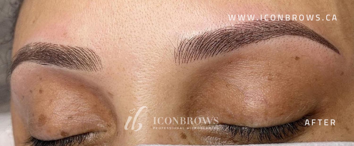 Top duo combo brows after fusion brows by Iconbrows Toronto.