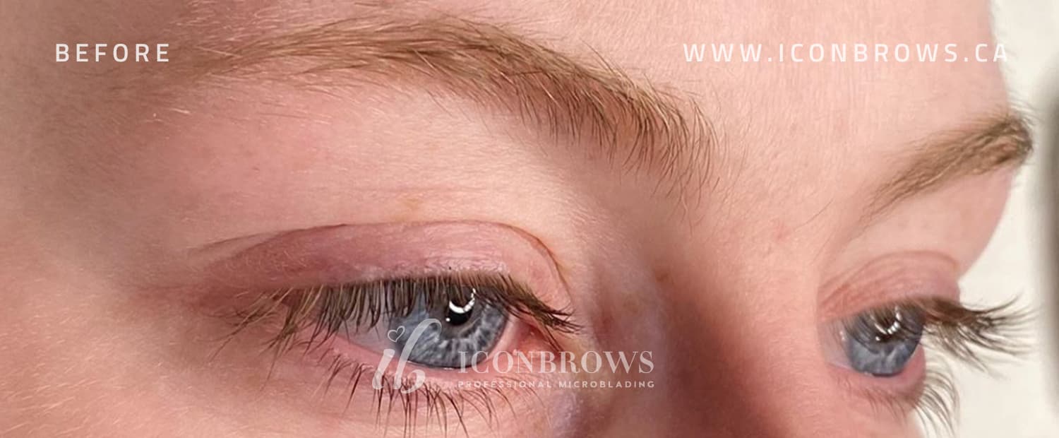 Female eyes before lash lift by Iconbrows in Toronto.