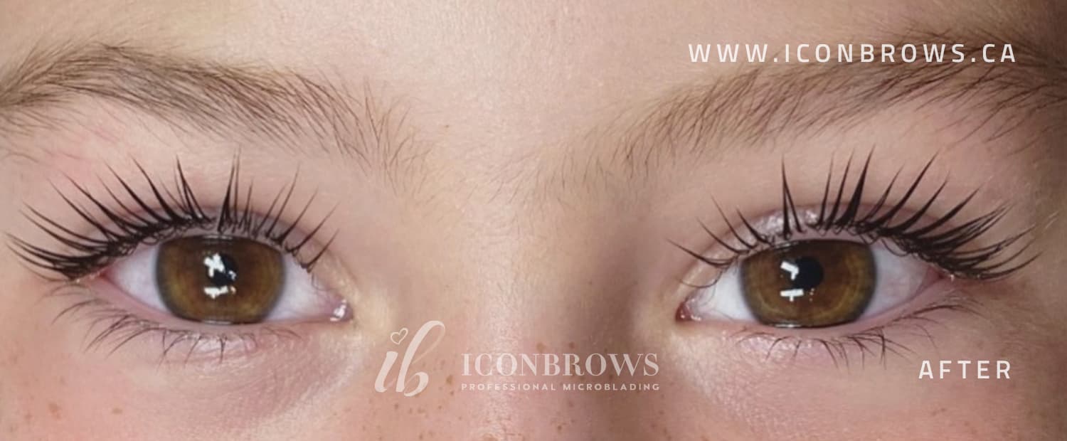 Young female eyes lifted with lash lift by Iconbrows in Toronto.