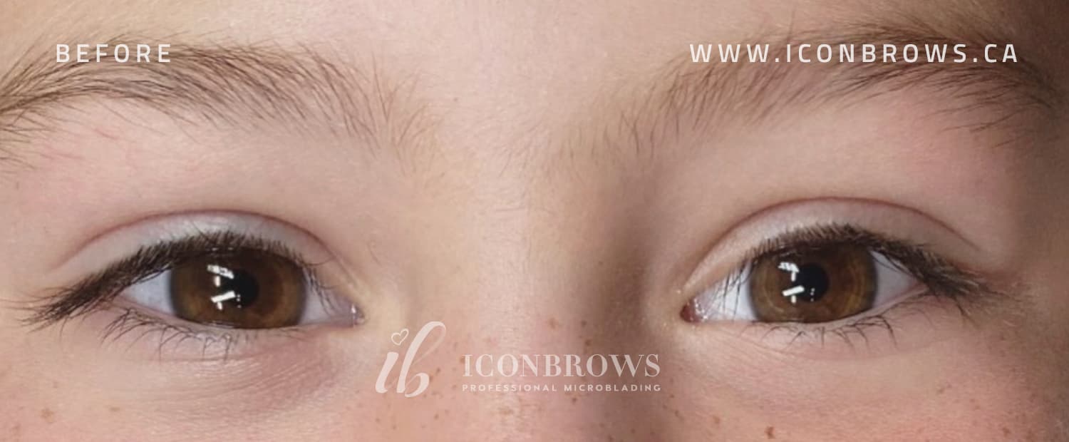 Young female eyes with normal lashes in Toronto.