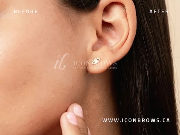 Organic ear candling by Iconbrows in Toronto.
