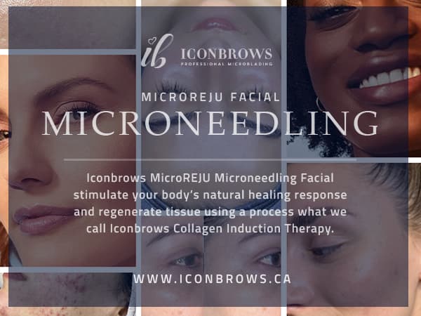 MicroReju microneedling facial by Iconbrows in Toronto.