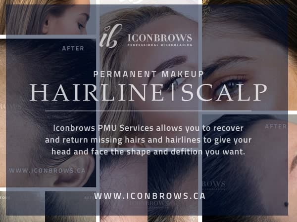 Hairline scalp permanent makeup to correct and recover the hairline in Toronto, Ontario.