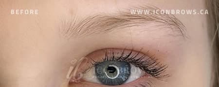 Eyebrows before nano brows by Iconbrows Toronto.