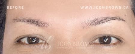 Eyebrows before nano brows by Iconbrows Toronto.