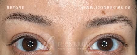 Eyebrows before nano brows by Iconbrows Toronto.