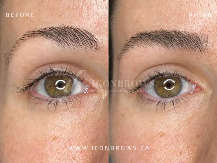 Nano brows recovery and correction by Iconbrows Toronto.