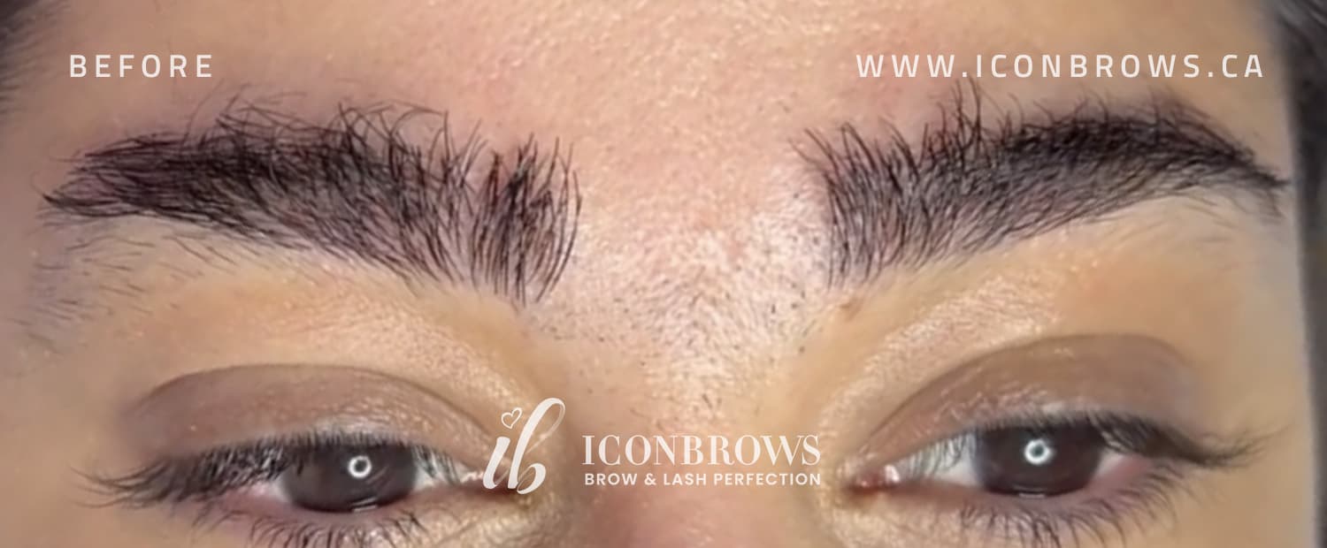 Eyebrows before threading cleanup by Iconbrows in Toronto.