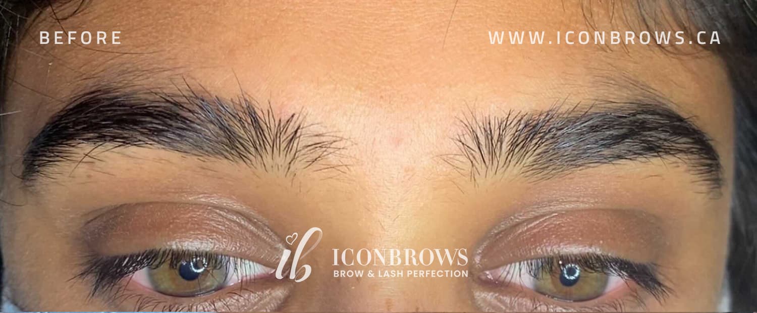 Bushy eyebrows before threading in Toronto.