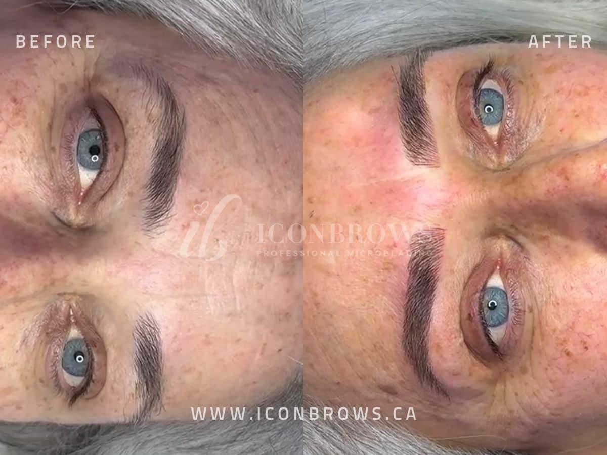 combo eyebrow tattoo correction by iconbrows toronto's top microblading studio.
