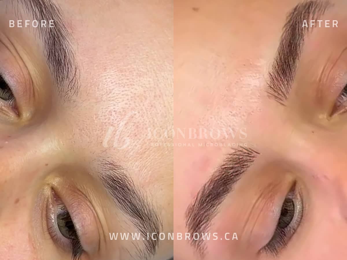 Microblading Near Me Etobicoke Toronto Iconbrows Top Eyebrows Recovery Corrections On Beautiful Woman