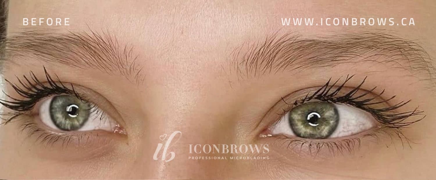 eyebrows before they receive microblading by Iconbrows.