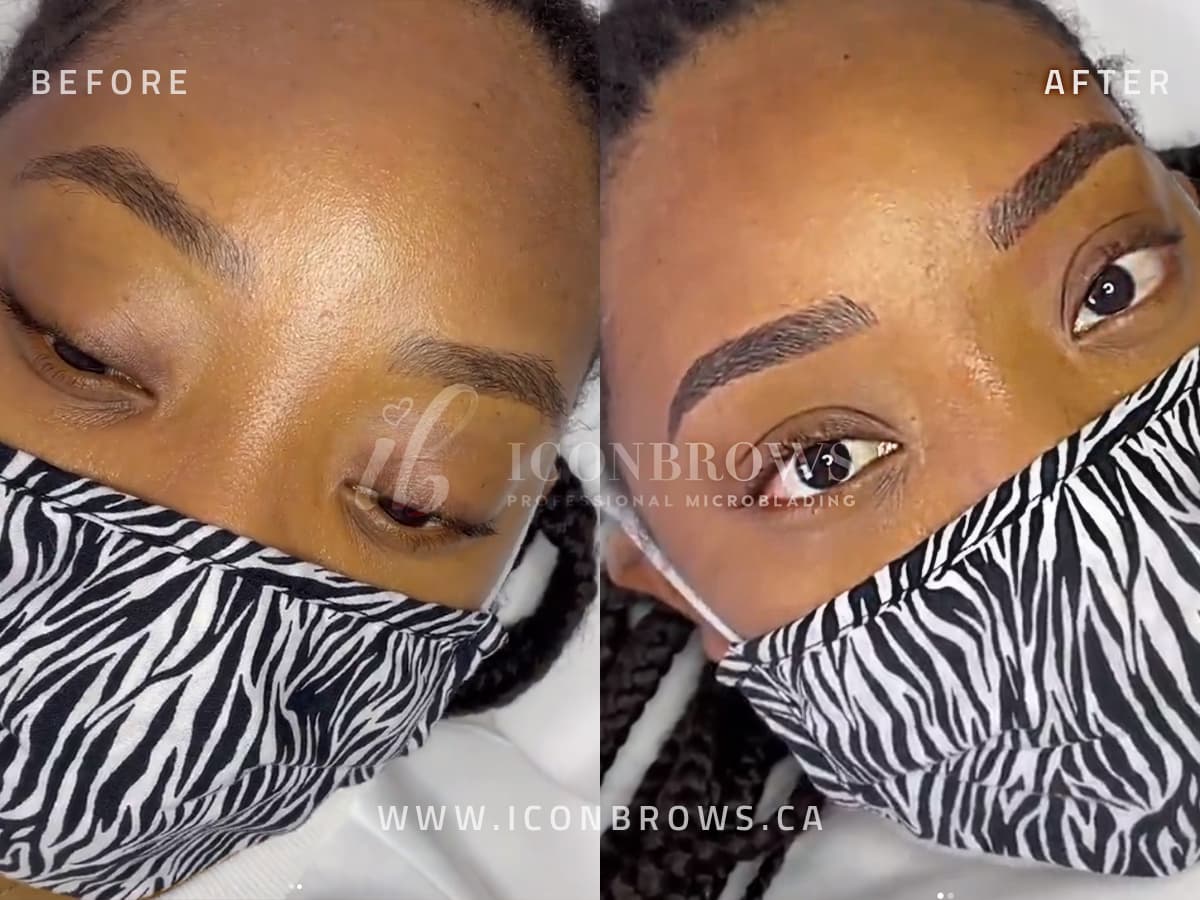 combo eyebrow tattoo correction by iconbrows toronto's top microblading studio.