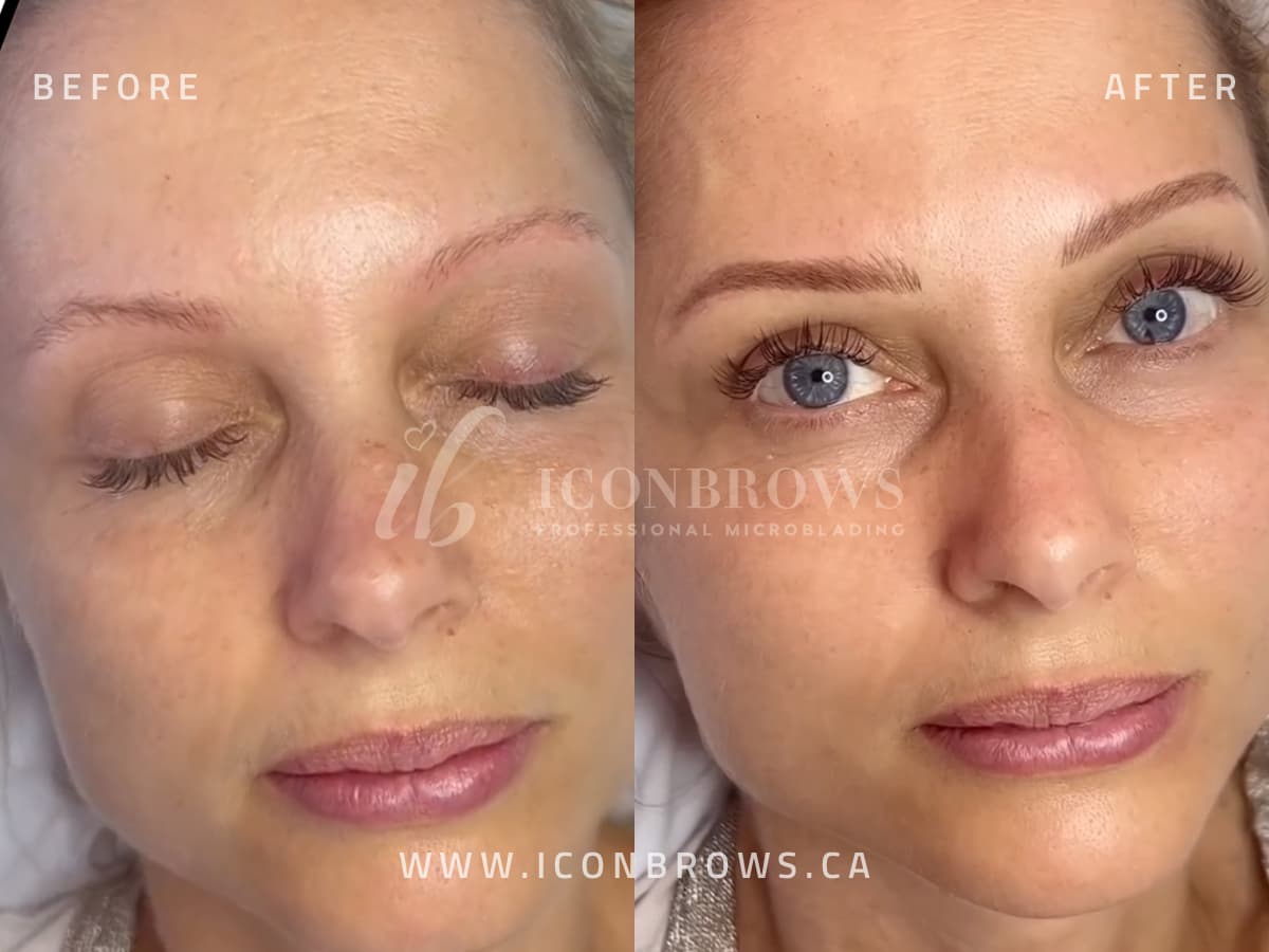 fusion brows service in etobicoke by iconbrows professional microblading