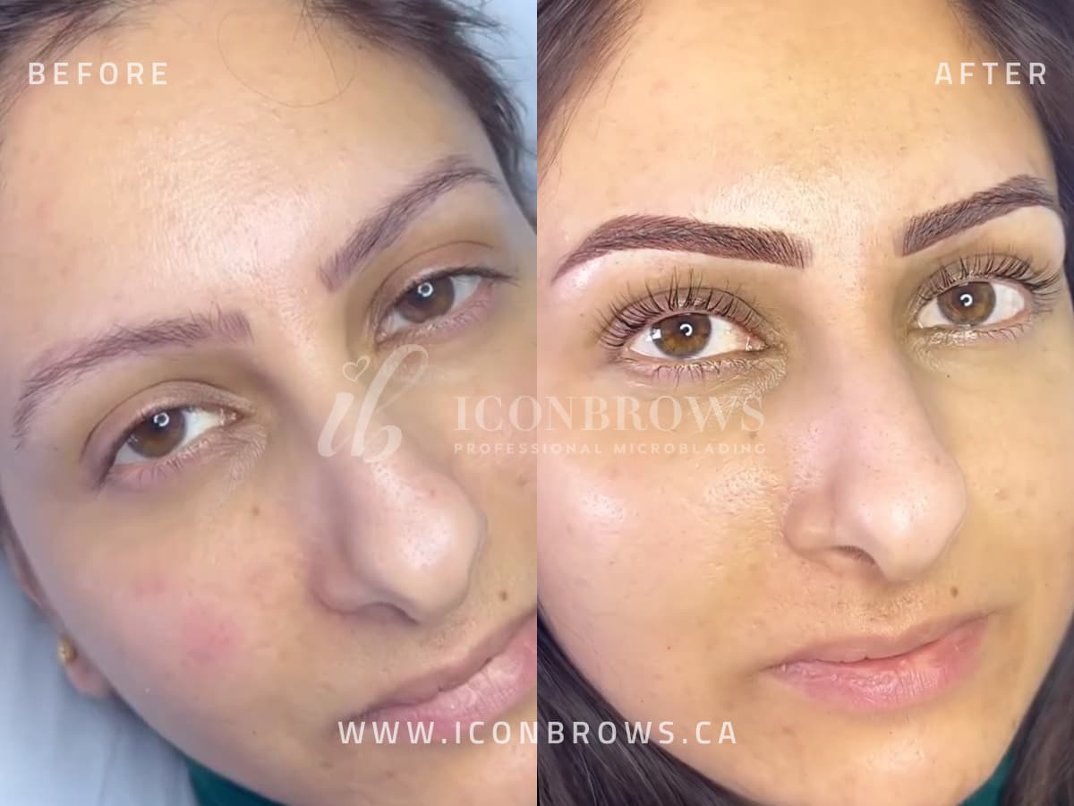 microblading microshading combo fusion brows by iconbrows torontos top microblading services look younger feel younger