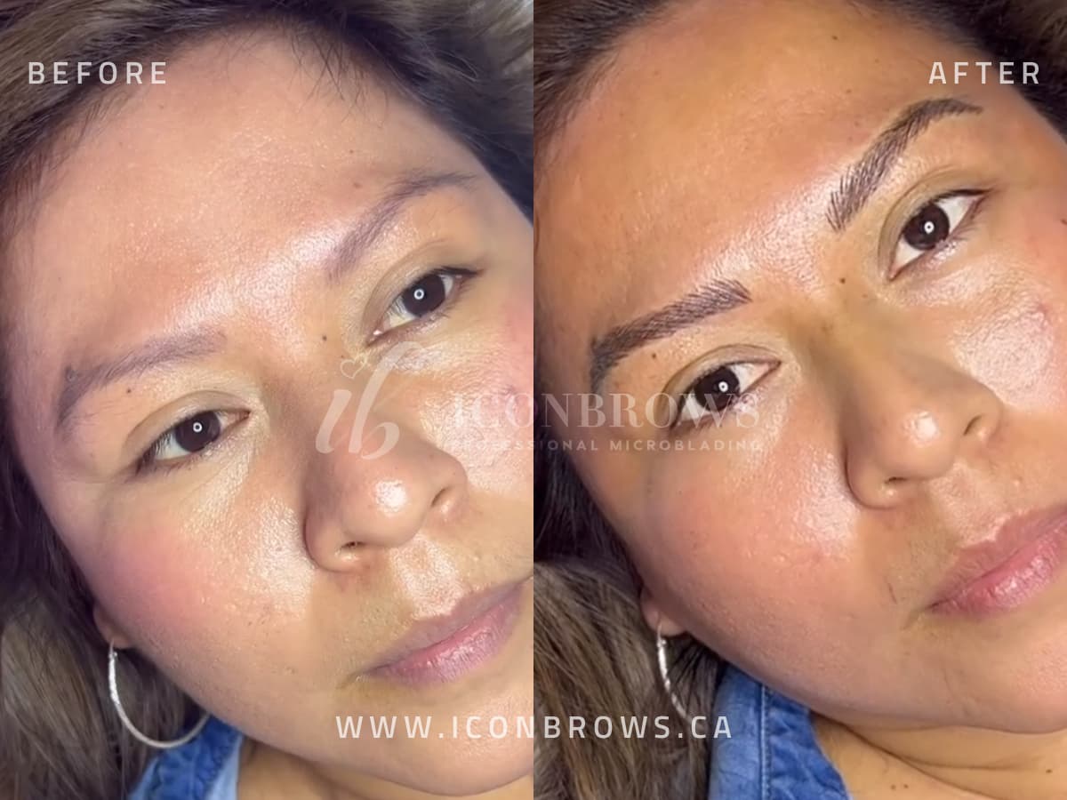 combo eyebrow tattoo correction by iconbrows toronto's top microblading studio.