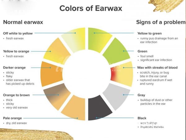 colors of ear wax instructions by iconbrows in toronto ontario.