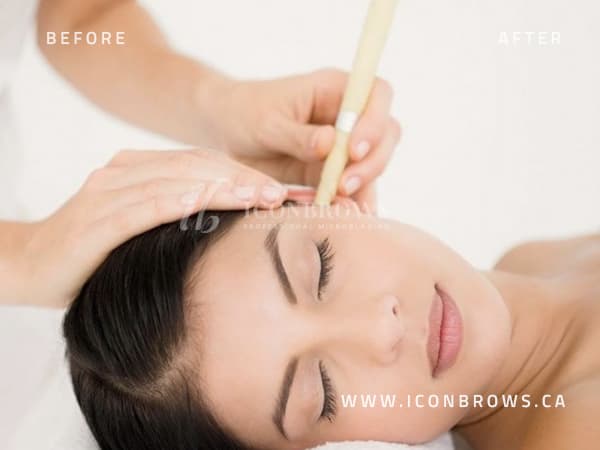 natural organic beeswax ear candling by iconbrows in toronto ontario.