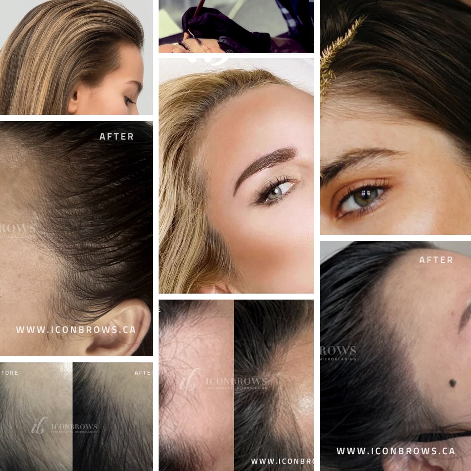 IconBrows Service Main Image beauty treatments toronto top hairline recovery