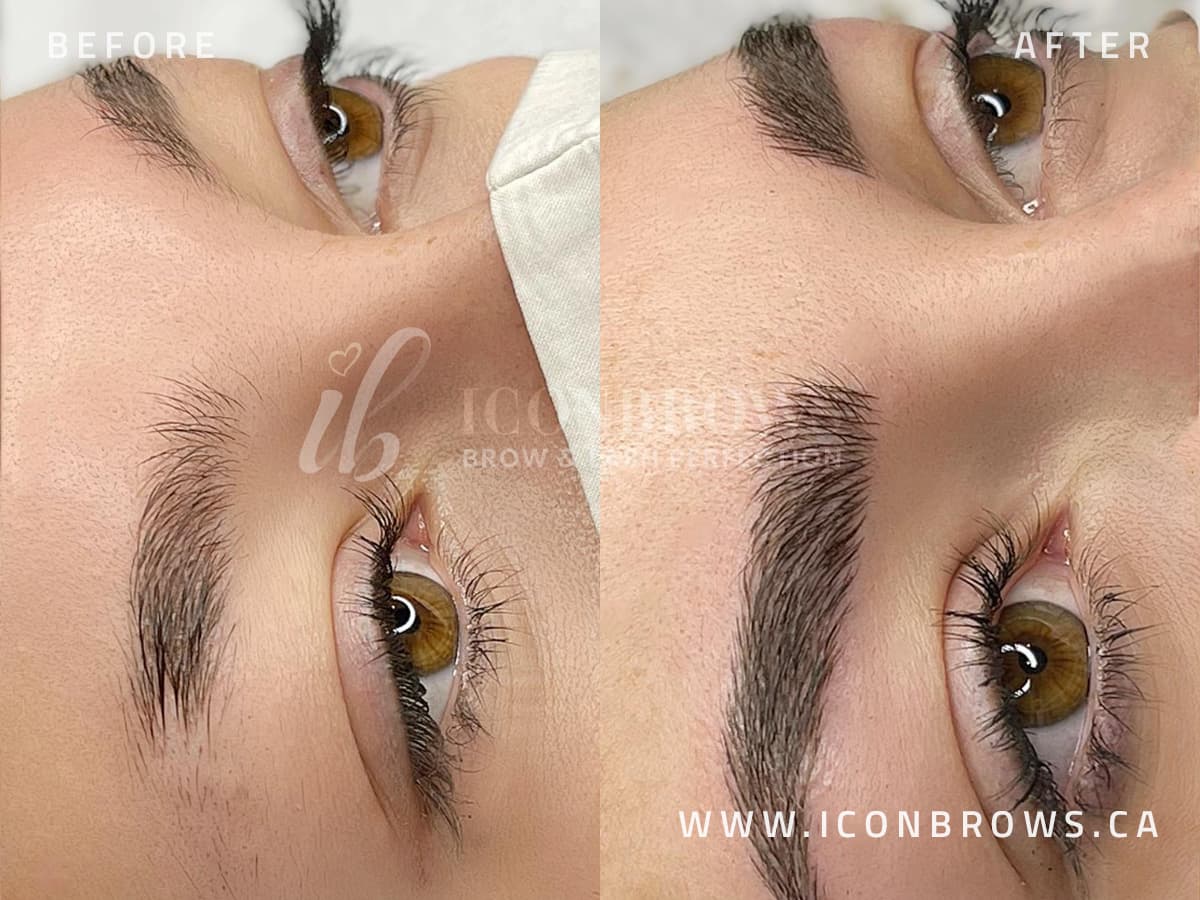 Eyebrow Microblading on young female eyebrows by Iconbrows.