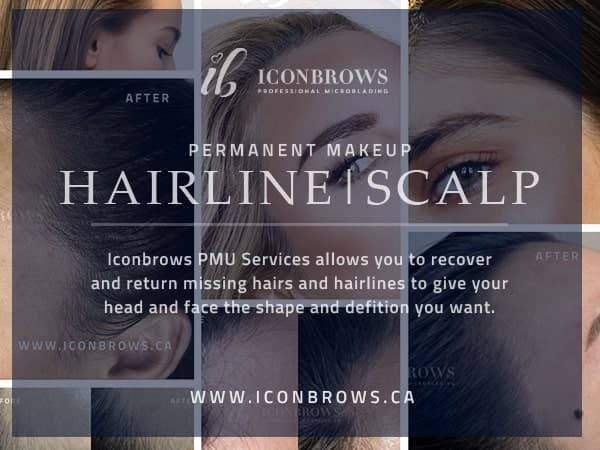 Hairline Scalp Permanent Makeup To Correct & Recover Hairline in Toronto Ontario