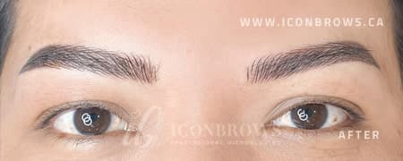 Eyebrows before they get the best Nano Brows service in Toronto
