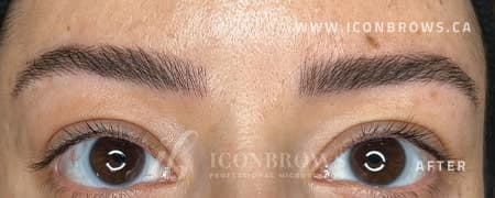 Eyebrows before being corrected with Nano Brows service in Toronto