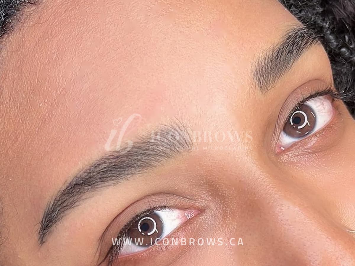 Toronto Nano Brows on female done by Iconbrows in toronto.