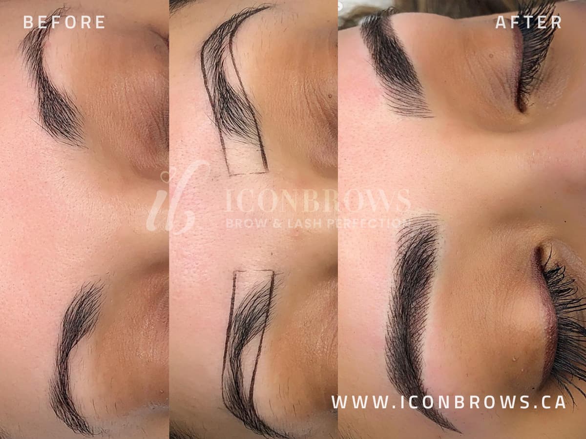 combo eyebrow tattoo correction by iconbrows toronto's top microblading studio.
