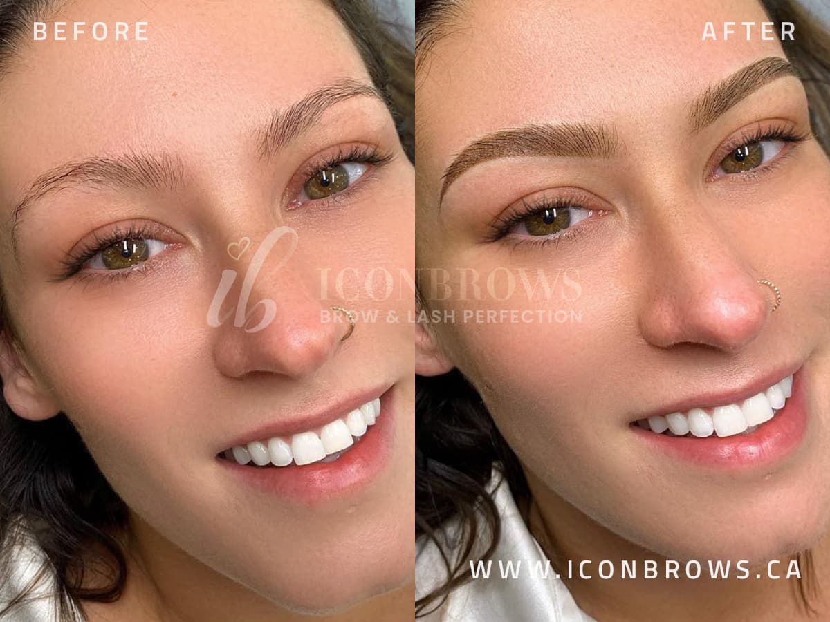 Toronto Microblading on female done by Iconbrows in toronto.