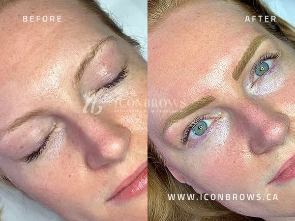Microblading Near Me Etobicoke Toronto Iconbrows Top Eyebrows Recovery Corrections On Beautiful Woman