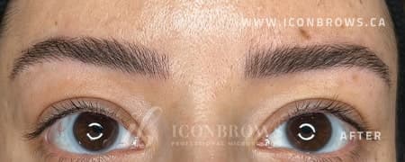 Eyebrows after nano brows by Iconbrows Toronto.