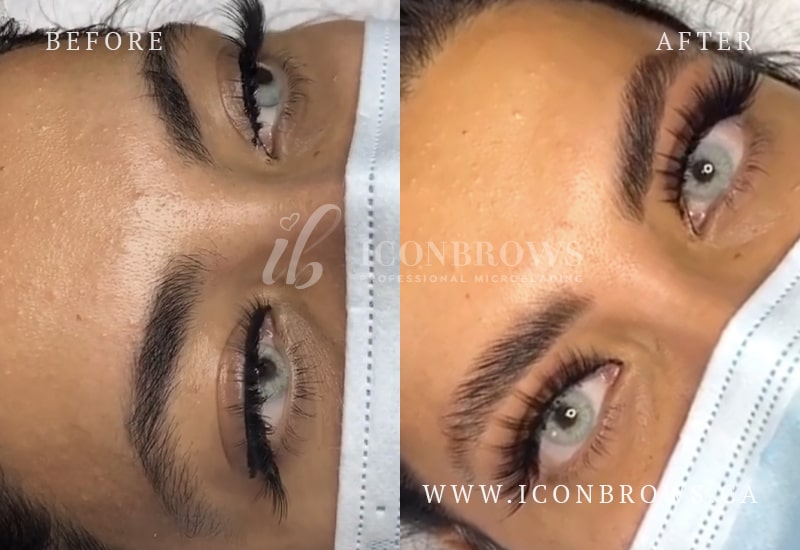 Brow lamination treatment at Iconbrows Toronto studio in Etobicoke