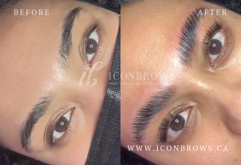 Lift and definition for brows with lamination by Iconbrows Toronto