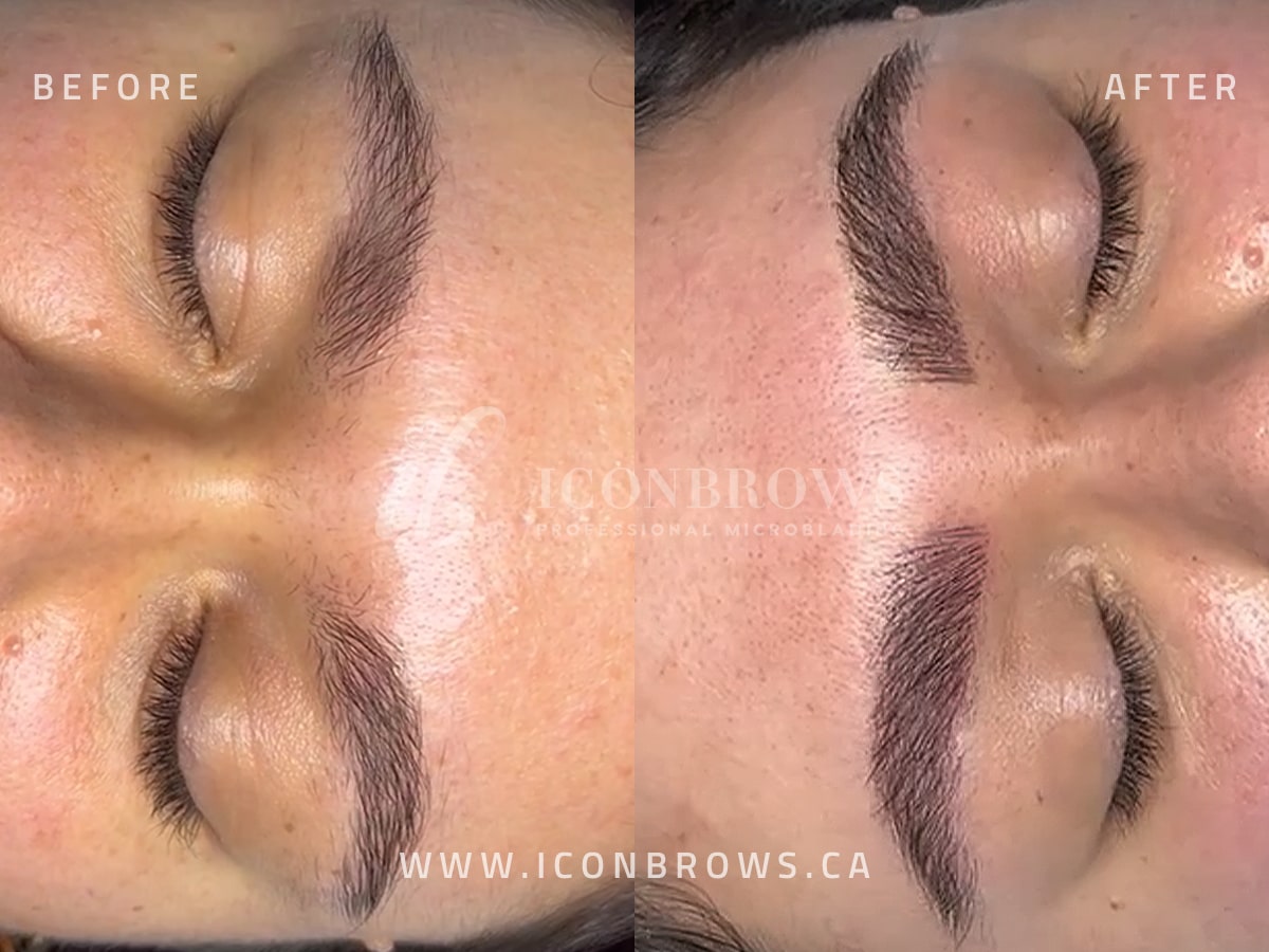 Individually created hair like strokes during microblading by Iconbrows Toronto
