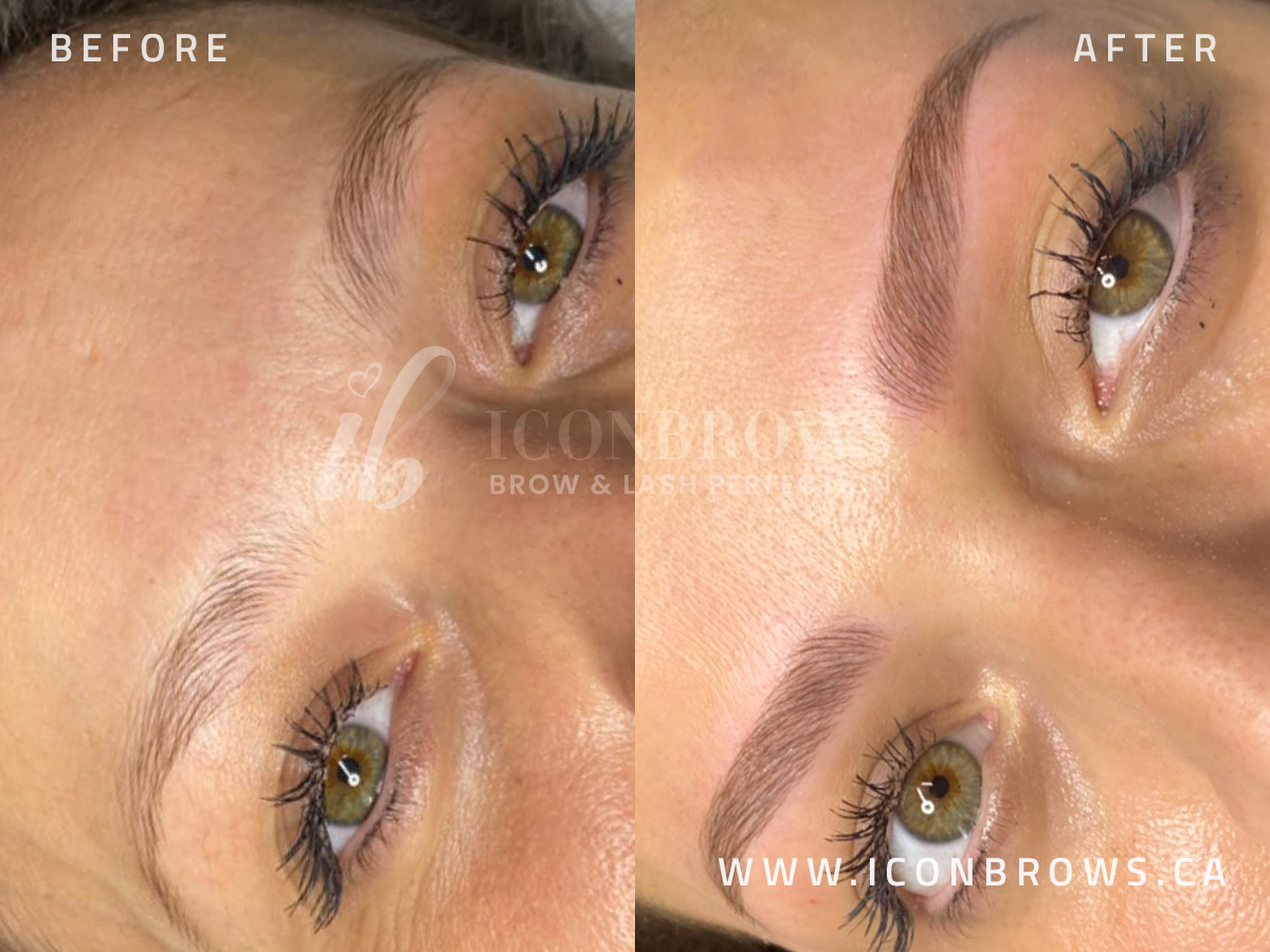 Eyebrow recovery with microblading by Iconbrows in Toronto