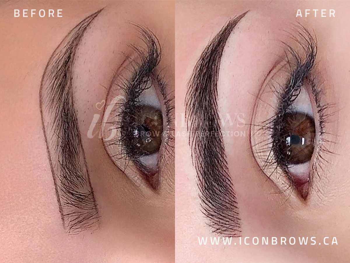 Natural looking microblading hair strokes by Iconbrows in Toronto