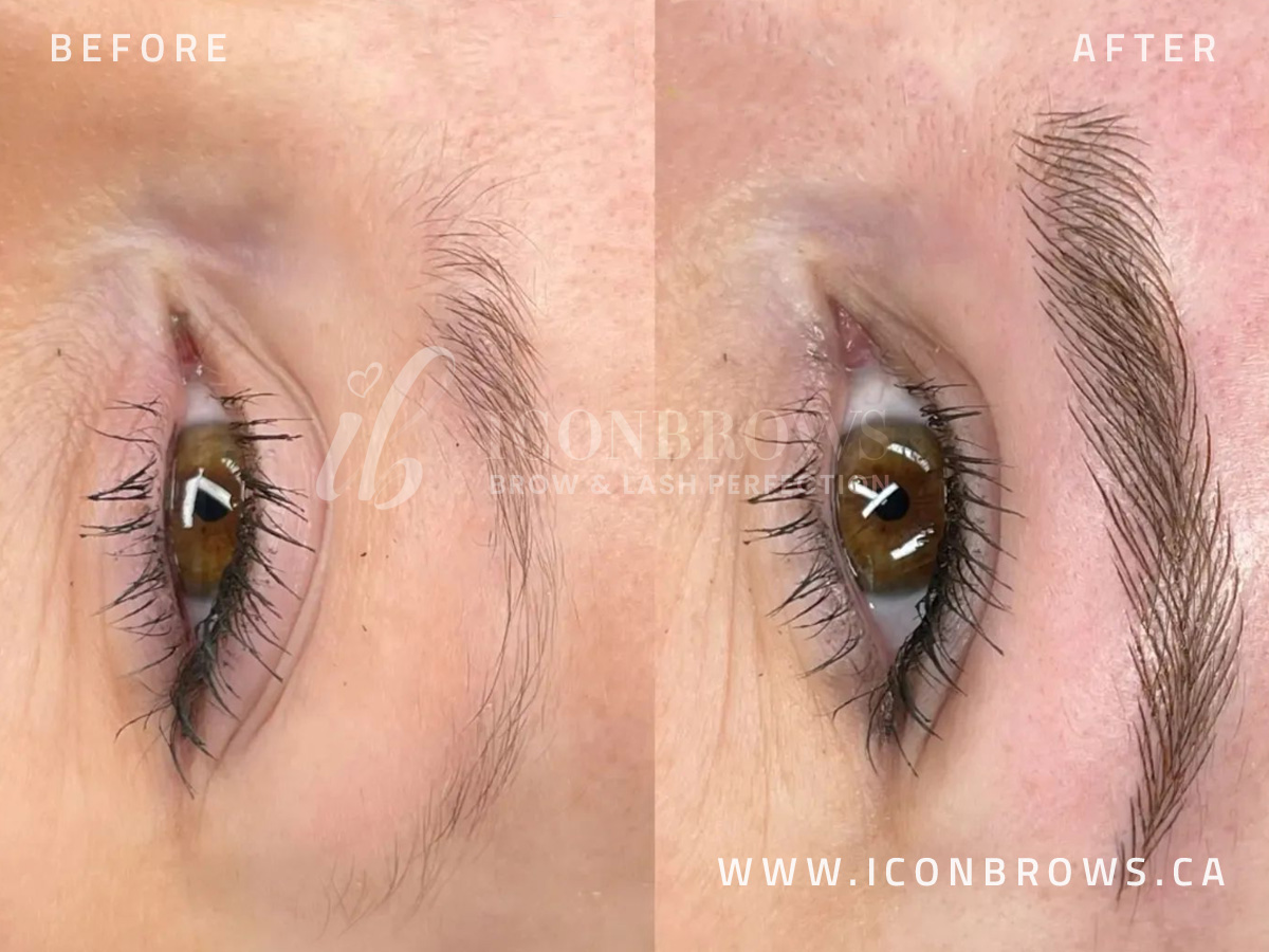 Microblading hair strokes in Toronto by Iconbrows