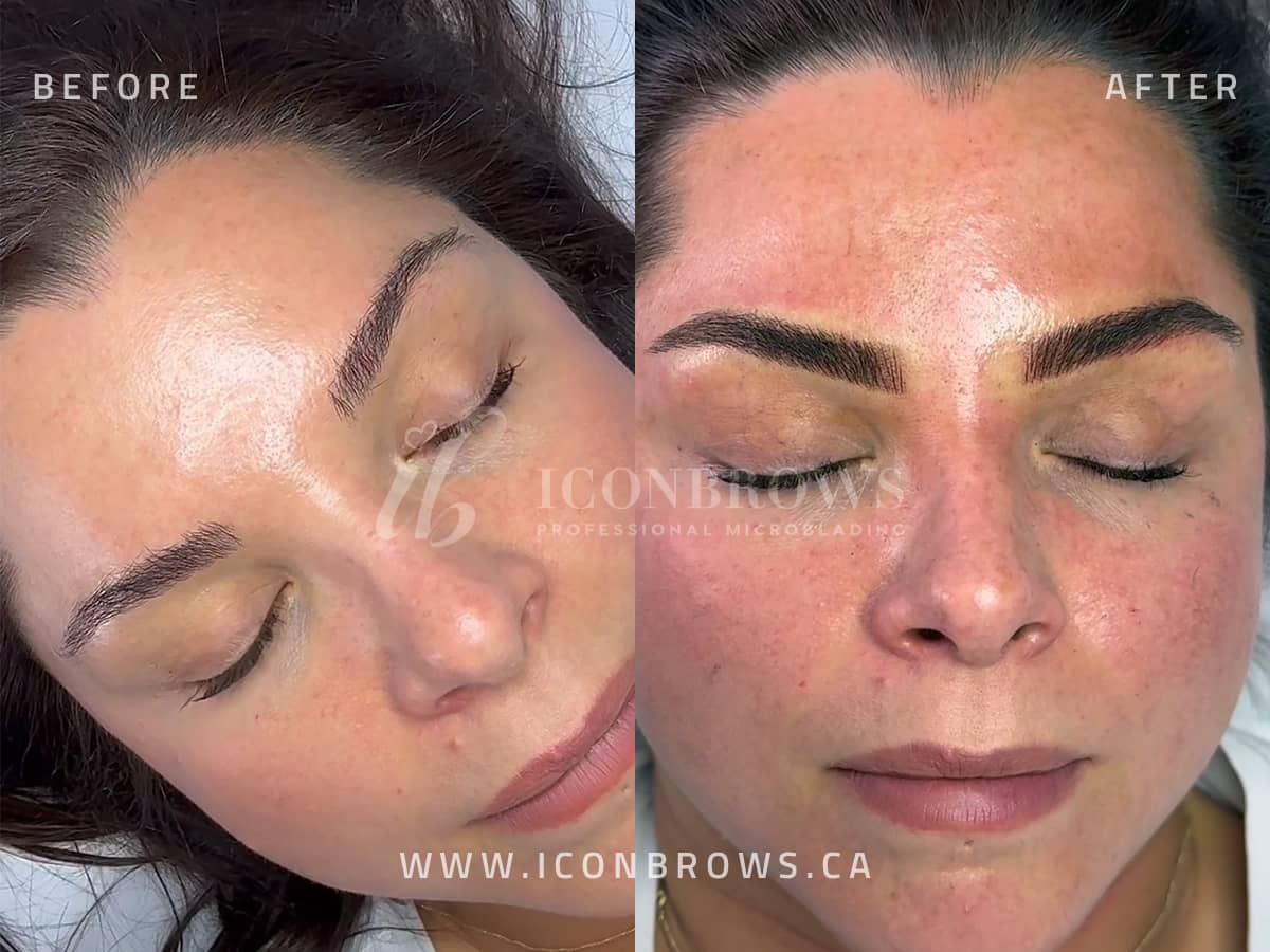 Fusion brows filling gaps and creating symmetry by Iconbrows Toronto