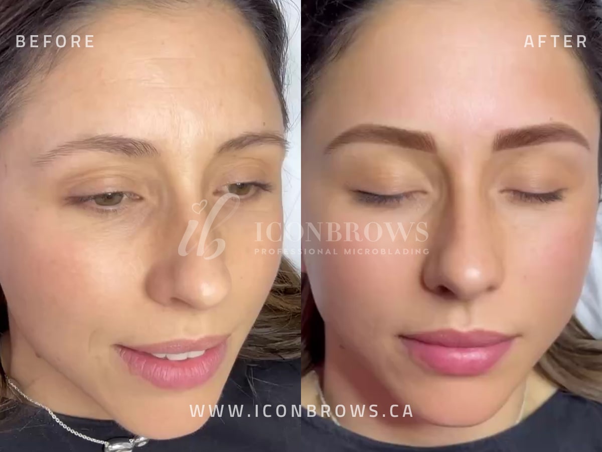 Hyper-realistic fusion brows eyebrow correction in Humber Bay Shores, Etobicoke by Iconbrows