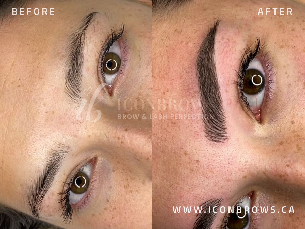 Fusion brows combining microblading and microshading by Iconbrows Toronto